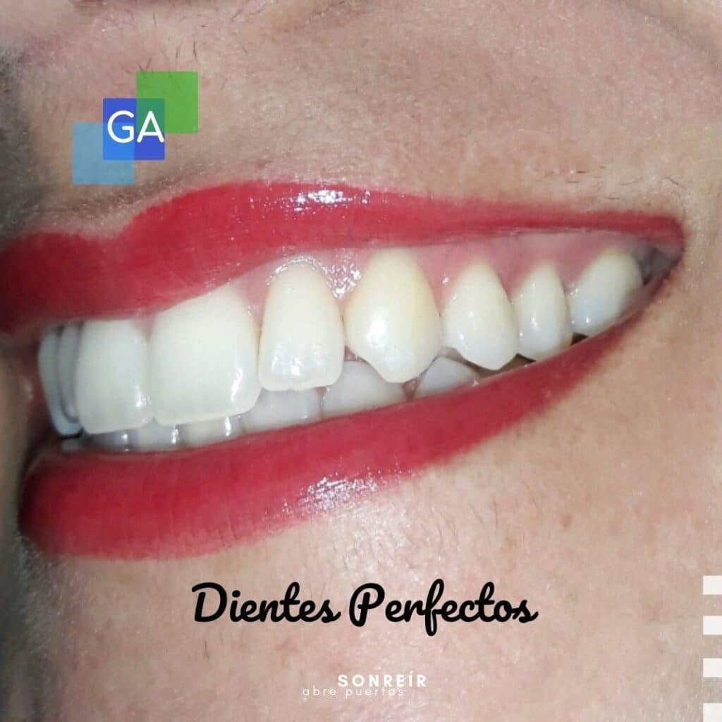 dientes perfectos