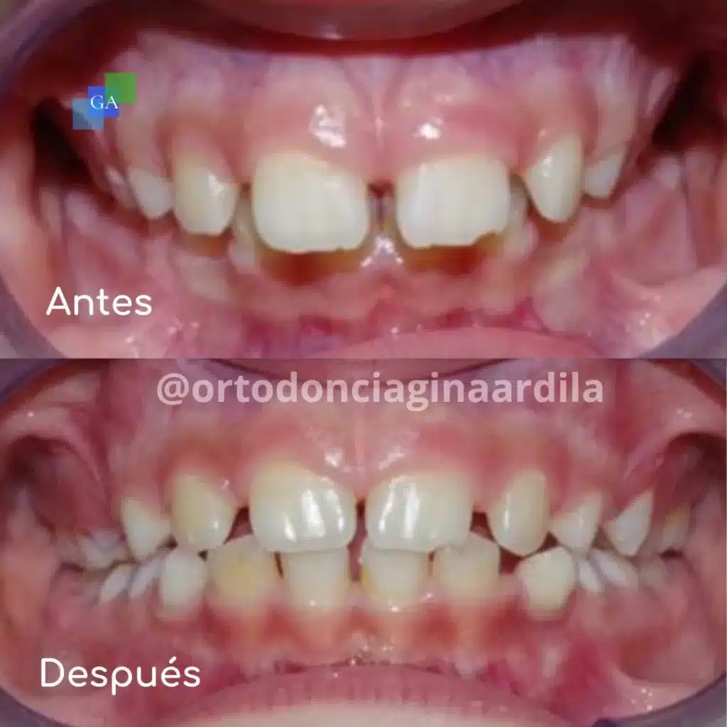 ortopedia maxilar en bogota